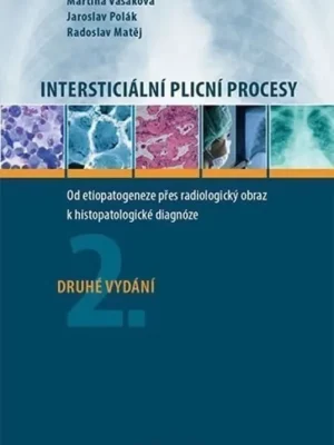 Intersticiální plicní procesy          : od etiopatogeneze přes radiologický obraz k histopatologické diagnóze Ihned K Objednání
