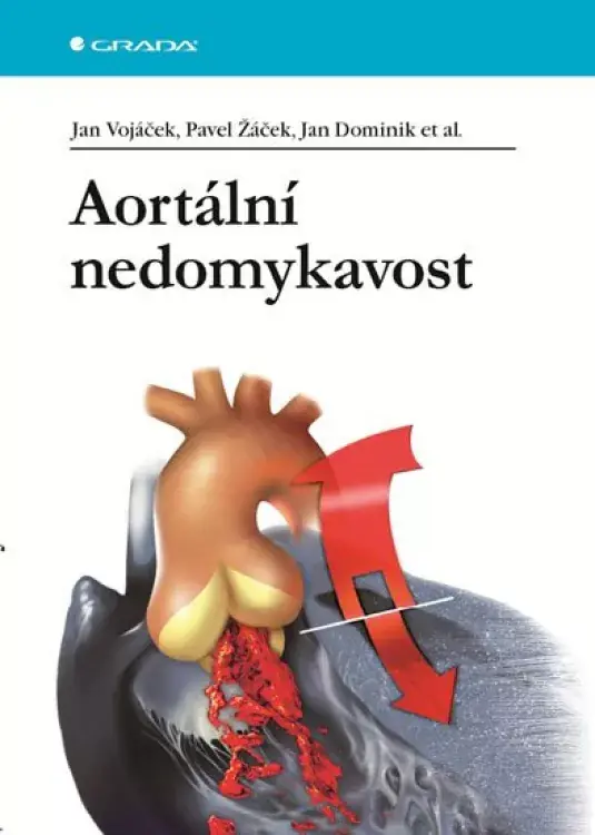 Aortální nedomykavost Vrácení Zdarma