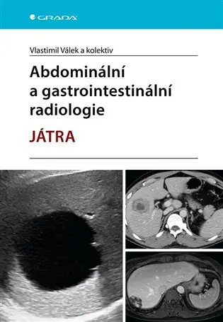 Abdominální a gastrointestinální radiologie - Játra Tovární Cena